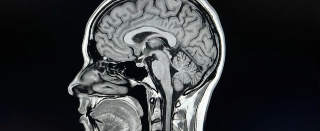 Familiarity-Forward Routes – Why Partial Predictability Creates Deeper Travel Ease