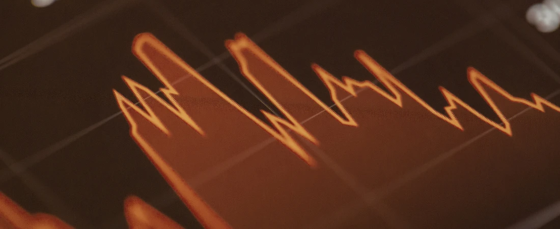 Volatility Exposure Scheduling – Choosing When to View Investment Swings